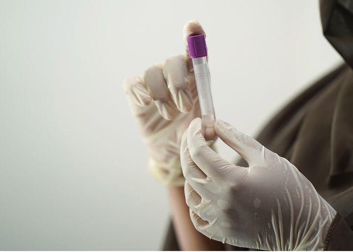 Beyond Guessing: Why Lab Testing Unlocks Women's Health